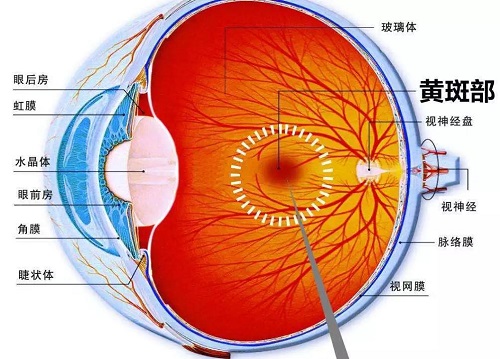 什么是黄斑变性？